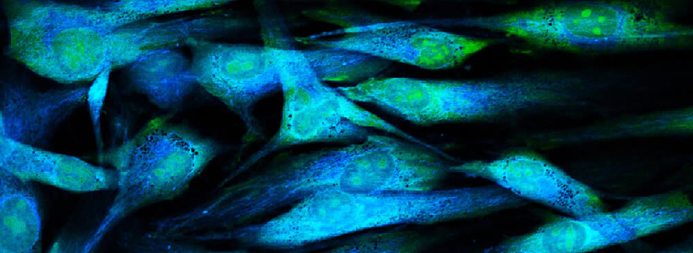 OmniLog® Phenotyping MicroArray System (PM & PMM)