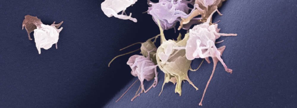 Agonisten für Thrombozyten Aggregation nach Born