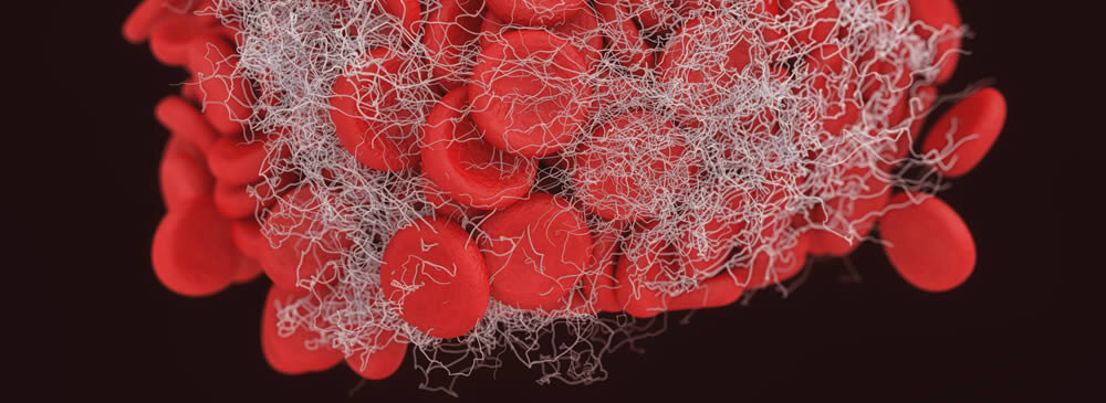 Coffrets coagulation et hémostase